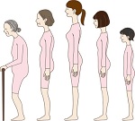 Forward Head Posture Symptoms and Solutions